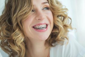 Am I Too Old for Braces?
