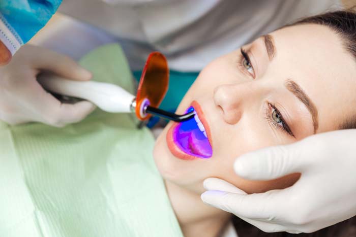 Restoration and filling of teeth with laser