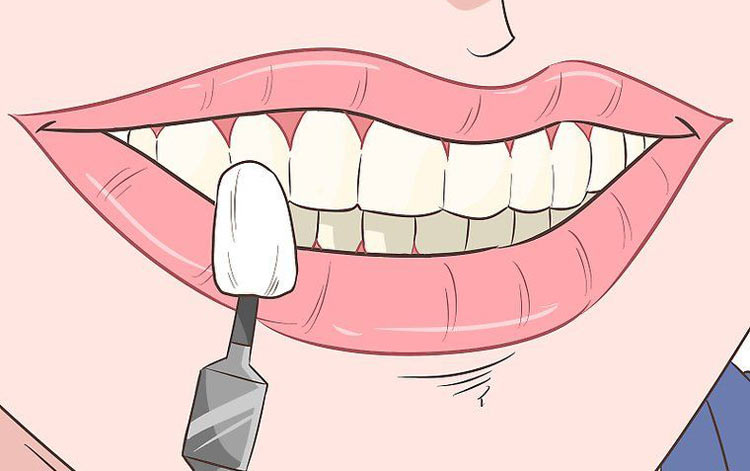 Straightening Your Teeth Without Braces