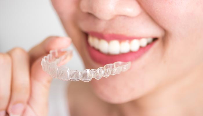 Why Invisalign Can Help Your Smile?