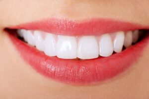 best dentist for veneers