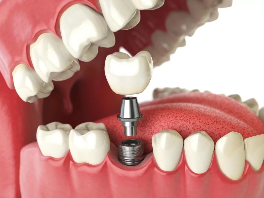 cosmetic dentistry Ancaster