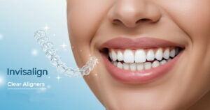 What is Invisalign and How Does It Work?