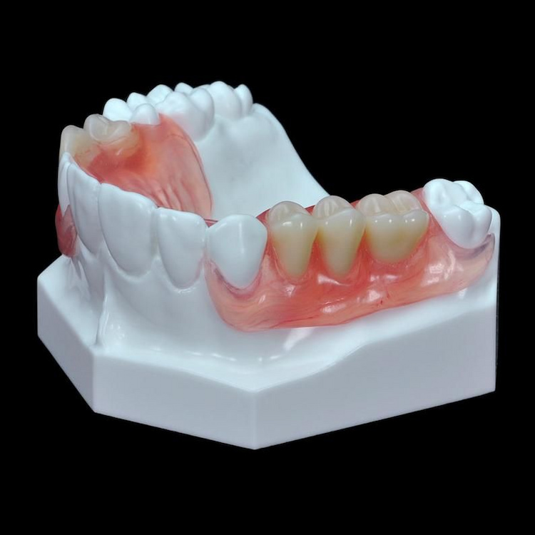 Partial Dentures