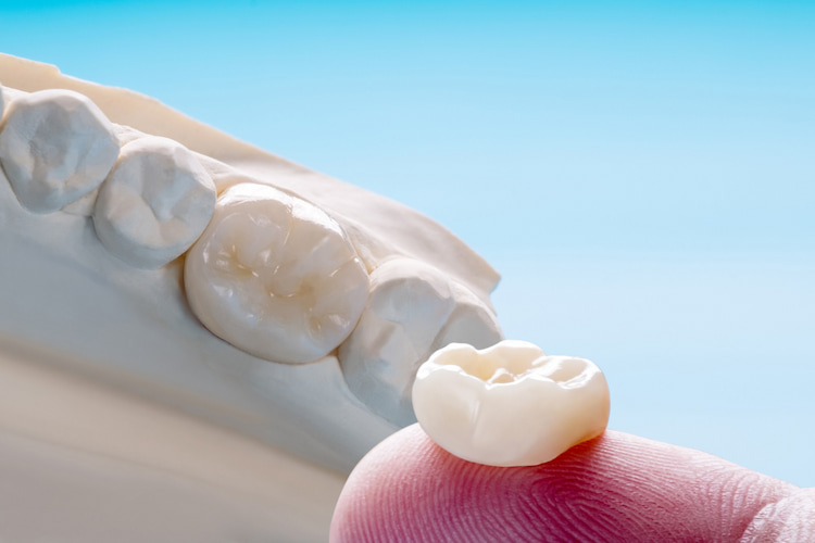 a dental crown on a finger next to artificial teeth.