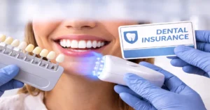 A picture representing the teeth whitening insurance coverage
