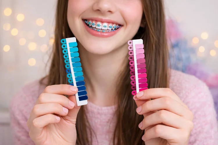 An image of a girl showing 2 different shades of braces color