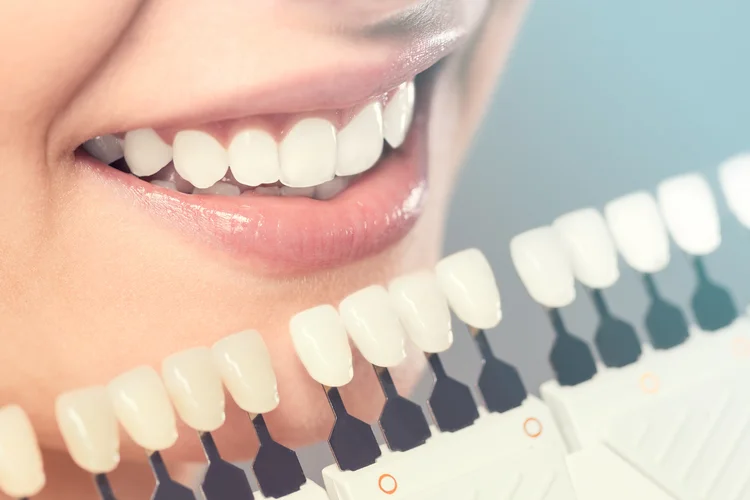A picture showing a patient choosing between different teeth color options for cosemtic dentistry