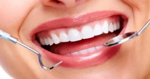 a picture of a woman with white teeth